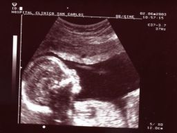 Bienvenido al weblog alejandria